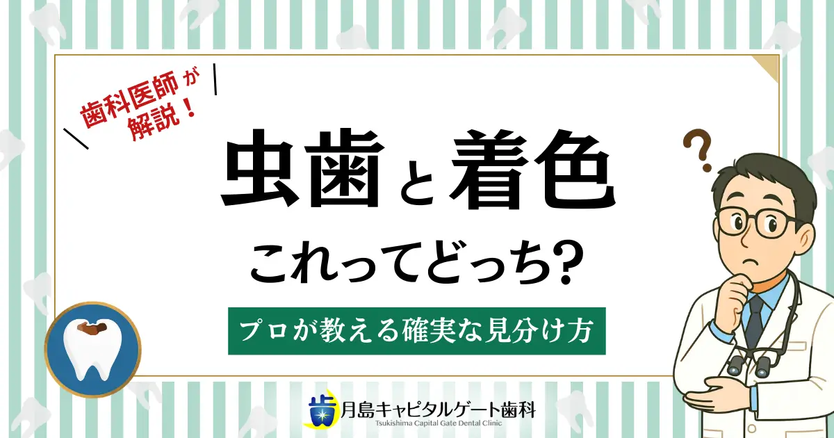 歯科医師が解説!虫歯と着色、これってどっち?プロが教える確実な見分け方