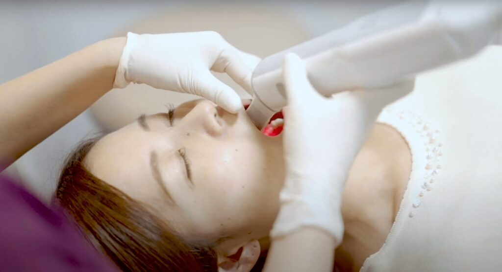 痛みや苦しさのないデジタル口腔内スキャナー、アイテロ