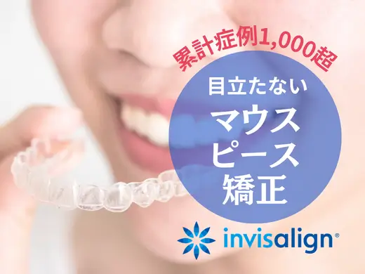 インビザライン