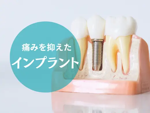 インプラント