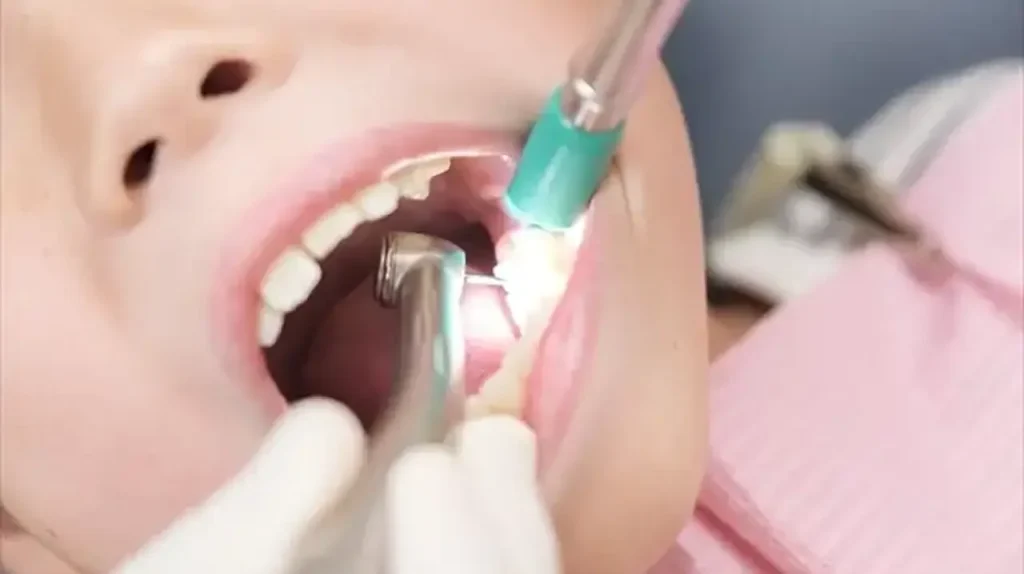 pediatric orthodontics 07 1
