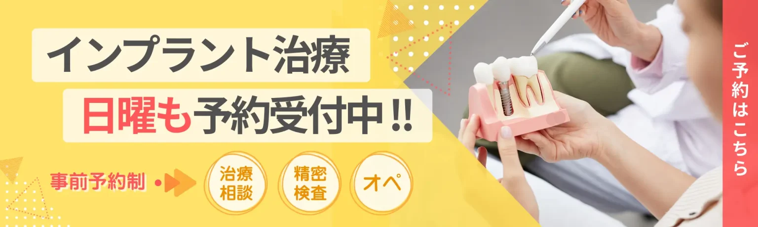 インプラント治療日曜も予約受付中！