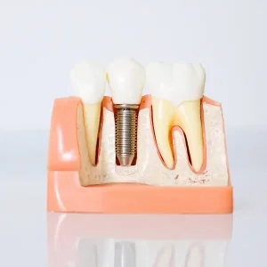 日曜診療インプラント・矯正相談（インビザライン）予約受付中_1